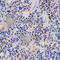 Proteasome 26S Subunit, Non-ATPase 3 antibody, A2790, ABclonal Technology, Immunohistochemistry paraffin image 
