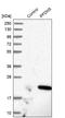 Prefoldin Subunit 5 antibody, NBP1-82639, Novus Biologicals, Western Blot image 