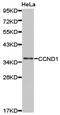 Cyclin D1 antibody, TA327031, Origene, Western Blot image 