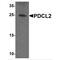 Phosducin Like 2 antibody, TA349068, Origene, Western Blot image 