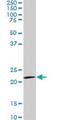 Interleukin 17B antibody, H00050604-M01, Novus Biologicals, Western Blot image 