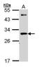 Cell Death Inducing DFFA Like Effector A antibody, PA5-29654, Invitrogen Antibodies, Western Blot image 