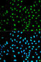 Neutrophil Cytosolic Factor 2 antibody, A02476, Boster Biological Technology, Western Blot image 