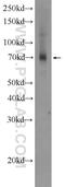 Ferredoxin-Fold Anticodon Binding Domain Containing 1 antibody, 24981-1-AP, Proteintech Group, Western Blot image 