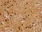 Zinc Finger Matrin-Type 3 antibody, LS-C405224, Lifespan Biosciences, Immunohistochemistry frozen image 