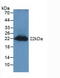 Regenerating Family Member 3 Gamma antibody, LS-C303163, Lifespan Biosciences, Western Blot image 