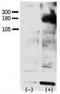 Erb-B2 Receptor Tyrosine Kinase 4 antibody, MBS9203212, MyBioSource, Western Blot image 