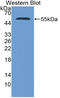 Nucleoporin 153 antibody, LS-C314706, Lifespan Biosciences, Western Blot image 