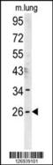 DnaJ Heat Shock Protein Family (Hsp40) Member C8 antibody, 61-980, ProSci, Western Blot image 