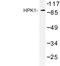 Mitogen-Activated Protein Kinase Kinase Kinase Kinase 1 antibody, LS-C176829, Lifespan Biosciences, Western Blot image 