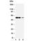 RAGE antibody, R30250, NSJ Bioreagents, Western Blot image 