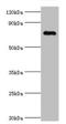 Cartilage Oligomeric Matrix Protein antibody, orb353594, Biorbyt, Western Blot image 