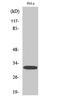 Protein Phosphatase 1 Regulatory Inhibitor Subunit 1B antibody, STJ90243, St John