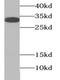 TNF Superfamily Member 11 antibody, FNab07108, FineTest, Western Blot image 