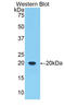 ALOX5 antibody, LS-C297969, Lifespan Biosciences, Western Blot image 