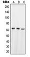 Nuclear Receptor Subfamily 4 Group A Member 1 antibody, LS-C352323, Lifespan Biosciences, Western Blot image 