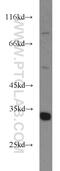 Enoyl-CoA Hydratase 1 antibody, 11385-1-AP, Proteintech Group, Western Blot image 