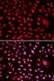 Core-Binding Factor Subunit Beta antibody, LS-C333969, Lifespan Biosciences, Immunofluorescence image 