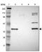 Serine Dehydratase Like antibody, PA5-52196, Invitrogen Antibodies, Western Blot image 