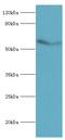 Activin A Receptor Type 2A antibody, MBS1497574, MyBioSource, Western Blot image 