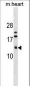 FXYD Domain Containing Ion Transport Regulator 7 antibody, LS-C159690, Lifespan Biosciences, Western Blot image 