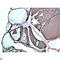 Transthyretin antibody, LS-C813242, Lifespan Biosciences, Immunohistochemistry paraffin image 
