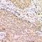 Protein Tyrosine Kinase 6 antibody, LS-C668173, Lifespan Biosciences, Immunohistochemistry paraffin image 