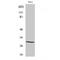 Adiponectin, C1Q And Collagen Domain Containing antibody, LS-C381935, Lifespan Biosciences, Western Blot image 