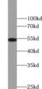 Vimentin antibody, FNab09408, FineTest, Western Blot image 