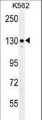 Integrin Subunit Alpha 8 antibody, LS-C165317, Lifespan Biosciences, Western Blot image 