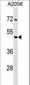 Tetrapeptide Repeat Homeobox 1 antibody, LS-C160147, Lifespan Biosciences, Western Blot image 