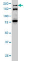 Extra Spindle Pole Bodies Like 1, Separase antibody, LS-B6199, Lifespan Biosciences, Western Blot image 