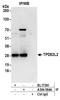 TPD52 Like 2 antibody, A304-584A, Bethyl Labs, Immunoprecipitation image 