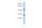 Pygopus Family PHD Finger 2 antibody, A05260, Boster Biological Technology, Western Blot image 