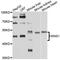 Kininogen 1 antibody, A1670, ABclonal Technology, Western Blot image 