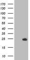 Deoxythymidylate Kinase antibody, TA503494, Origene, Western Blot image 