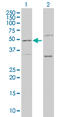 Prolyl 3-Hydroxylase 1 antibody, LS-C133804, Lifespan Biosciences, Western Blot image 