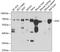 Glucosamine (N-Acetyl)-6-Sulfatase antibody, GTX33224, GeneTex, Western Blot image 