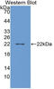 Beta-trace protein antibody, LS-C314600, Lifespan Biosciences, Western Blot image 