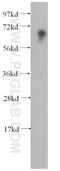 HIRA Interacting Protein 3 antibody, 14992-1-AP, Proteintech Group, Western Blot image 