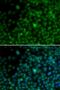 Interferon Regulatory Factor 4 antibody, LS-C331223, Lifespan Biosciences, Immunofluorescence image 