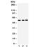 Matrix Metallopeptidase 10 antibody, R31922, NSJ Bioreagents, Western Blot image 