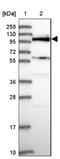 SIK Family Kinase 3 antibody, NBP2-47277, Novus Biologicals, Western Blot image 