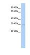 Ubiquitin Conjugating Enzyme E2 S antibody, NBP1-55056, Novus Biologicals, Western Blot image 