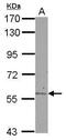 Aldehyde Dehydrogenase 6 Family Member A1 antibody, PA5-30090, Invitrogen Antibodies, Western Blot image 