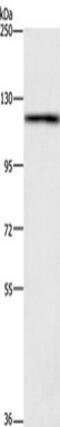 TSPY Like 2 antibody, TA351080, Origene, Western Blot image 