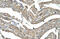 Asporin antibody, ARP42487_T100, Aviva Systems Biology, Immunohistochemistry paraffin image 