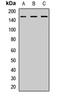 SPT5 Homolog, DSIF Elongation Factor Subunit antibody, LS-C668098, Lifespan Biosciences, Western Blot image 