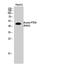 Phosphatase And Tensin Homolog antibody, STJ97361, St John