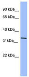 Killer Cell Immunoglobulin Like Receptor, Two Ig Domains And Long Cytoplasmic Tail 4 antibody, TA346319, Origene, Western Blot image 